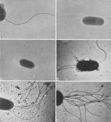  Bodonids! Microscopic Flagellates With Voracious Appetites For Bacteria